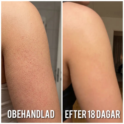 Smultis Slätande Kräm