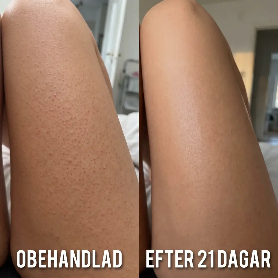 Smultis Slätande Kräm